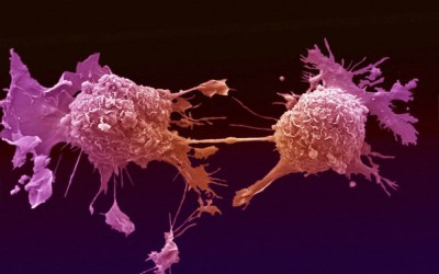 cancer-cells-31