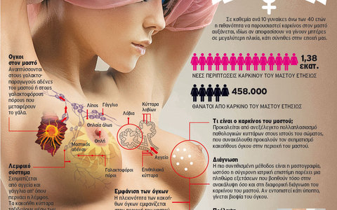 Η Μαστογραφία στέλνει τις γυναίκες πιο γρήγορα στο φέρετρο ,Dr. Μουρούτης